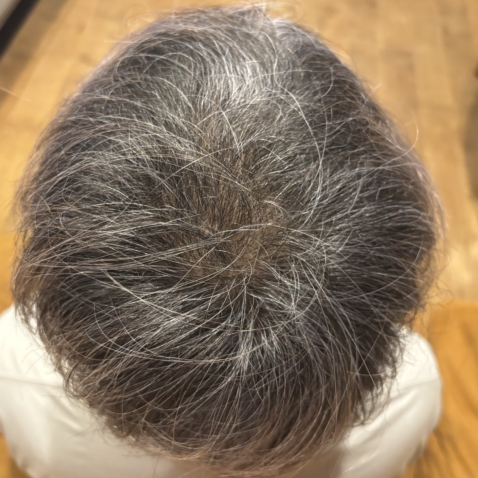 頭皮ケアの施術後の写真